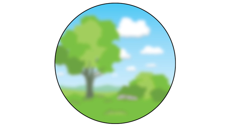 efterstær gør linsekapslen uklar og synet slørret