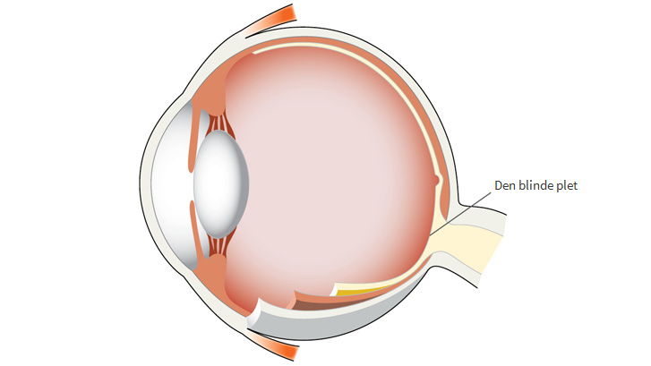 Find din blinde plet!